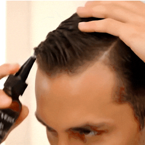 luxevéria Skalp Moisturuzing Oil When Water Feels Like Acid and Your Skin Is on Fire image luxevéria Skalp Moisturuzing Oil When Water Feels Like Acid and Your Skin Is on Fire